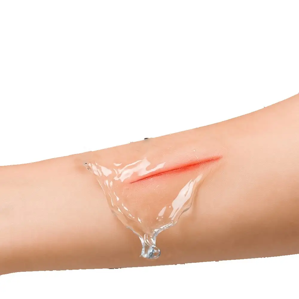 A clear Samaritan seal on a forearm