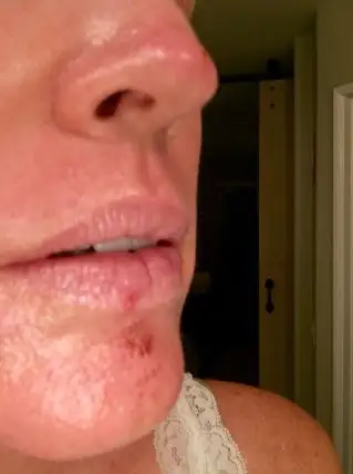 Day 2