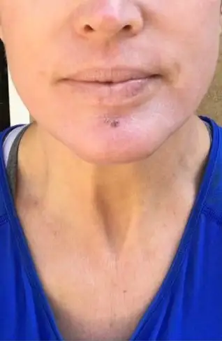 Day 3
