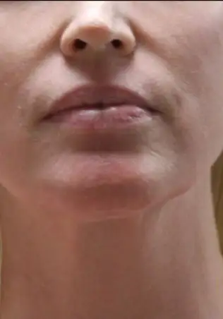 Day 4