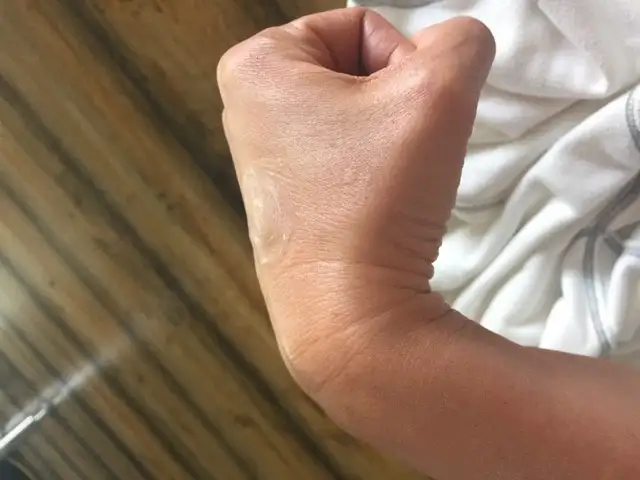 Gorilla Skin applied to the back of a hand